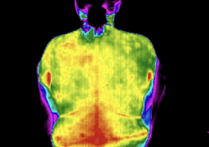 thermal image with with low back pain